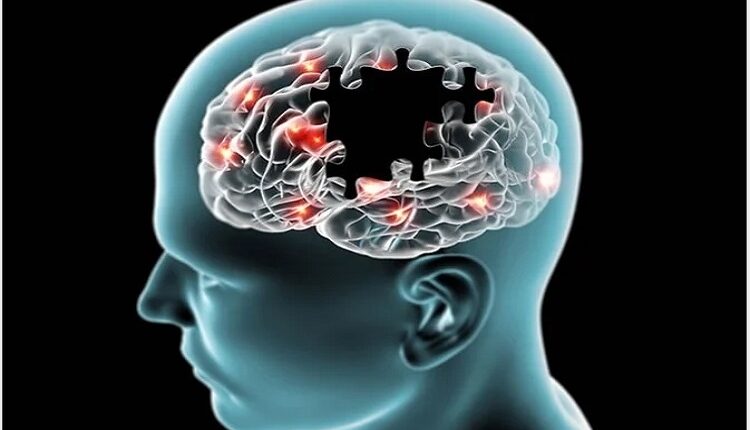Alzheimer's Disease